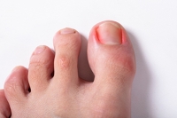 Ballet Can Cause Foot Injuries