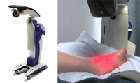 Shockwave Therapy May Help Chronic Foot Conditions